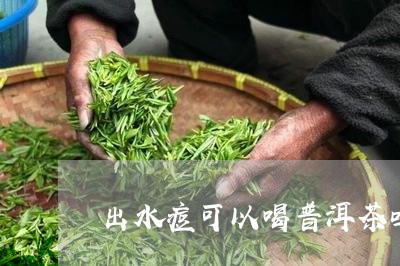 出水痘可以喝普洱茶吗/2023092904937