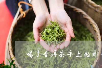 喝了普洱茶手上起疹子/2023062320585