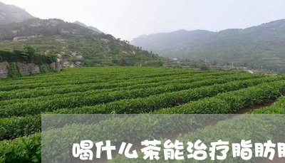 喝什么茶能治疗脂肪肝/2023071333149