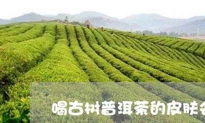 喝古树普洱茶的皮肤会变好吗/2023082957059