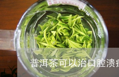 普洱茶可以治口腔溃疡嘛/2023081475850