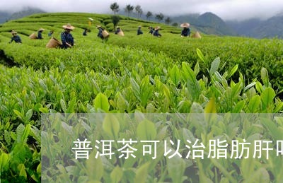 普洱茶可以治脂肪肝吗/2023061661735