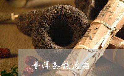 普洱茶能治癌/2023042561064