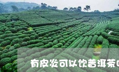 有皮炎可以饮普洱茶吗/2023062338416