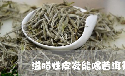 溢脂性皮炎能喝普洱茶/2023072468270