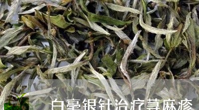 白毫银针治疗荨麻疹/2023091493594