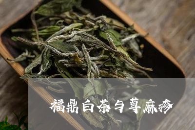 福鼎白茶与荨麻疹/2023112629493