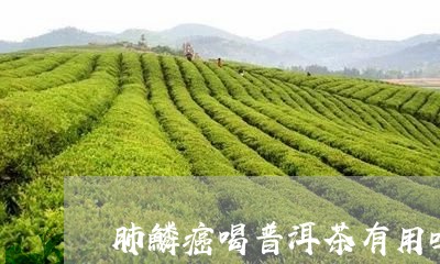 肺鳞癌喝普洱茶有用吗/2023072238460