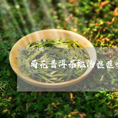 菊花普洱茶能治痘痘吗/2023073098262